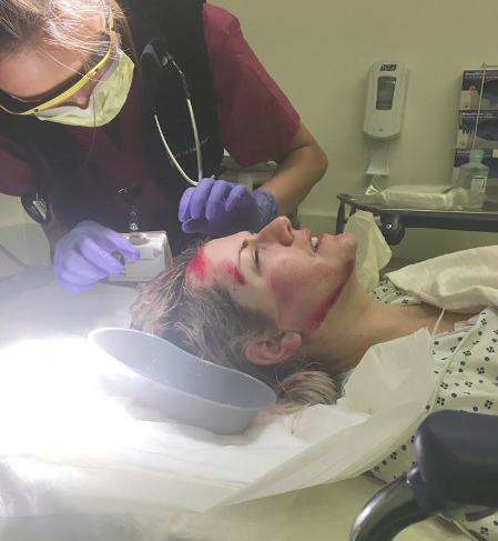 Are Injuries Not Enough to Get Safer Streets?