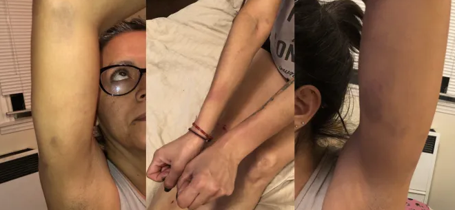 USC’s Public Safety Officers Tackle, Traumatize Woman for Hugging Tree on Sorority’s Lawn